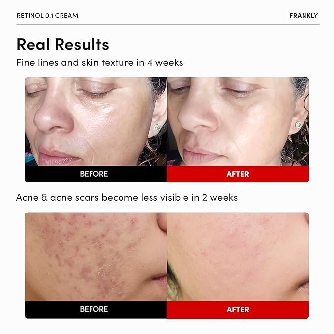 FRANKLY Retinol 0,1% crème — texture soyeuse pour une application en douceur.