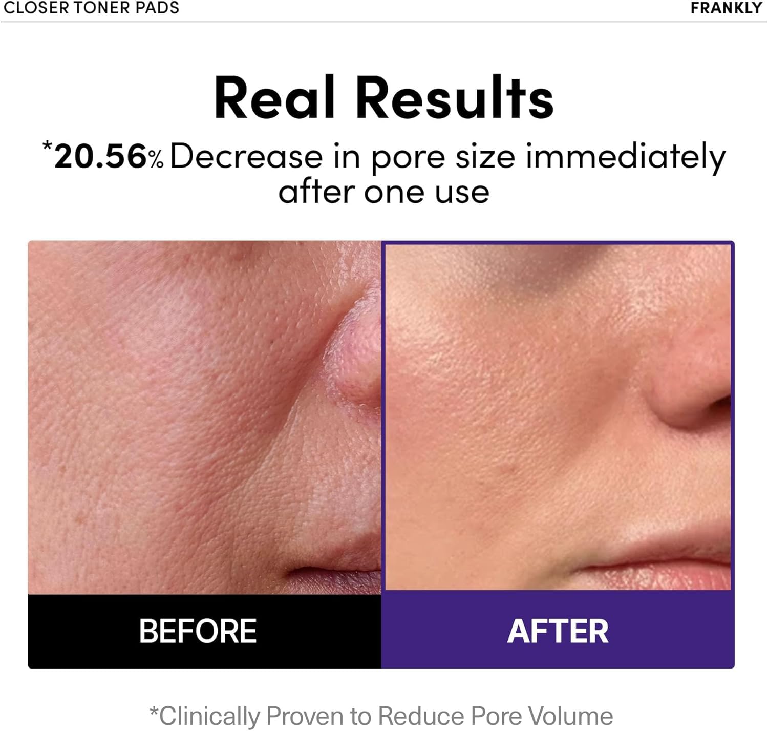 FRANKLY gelee riz 9 peptides – texture nourrissante et rafraichissante.