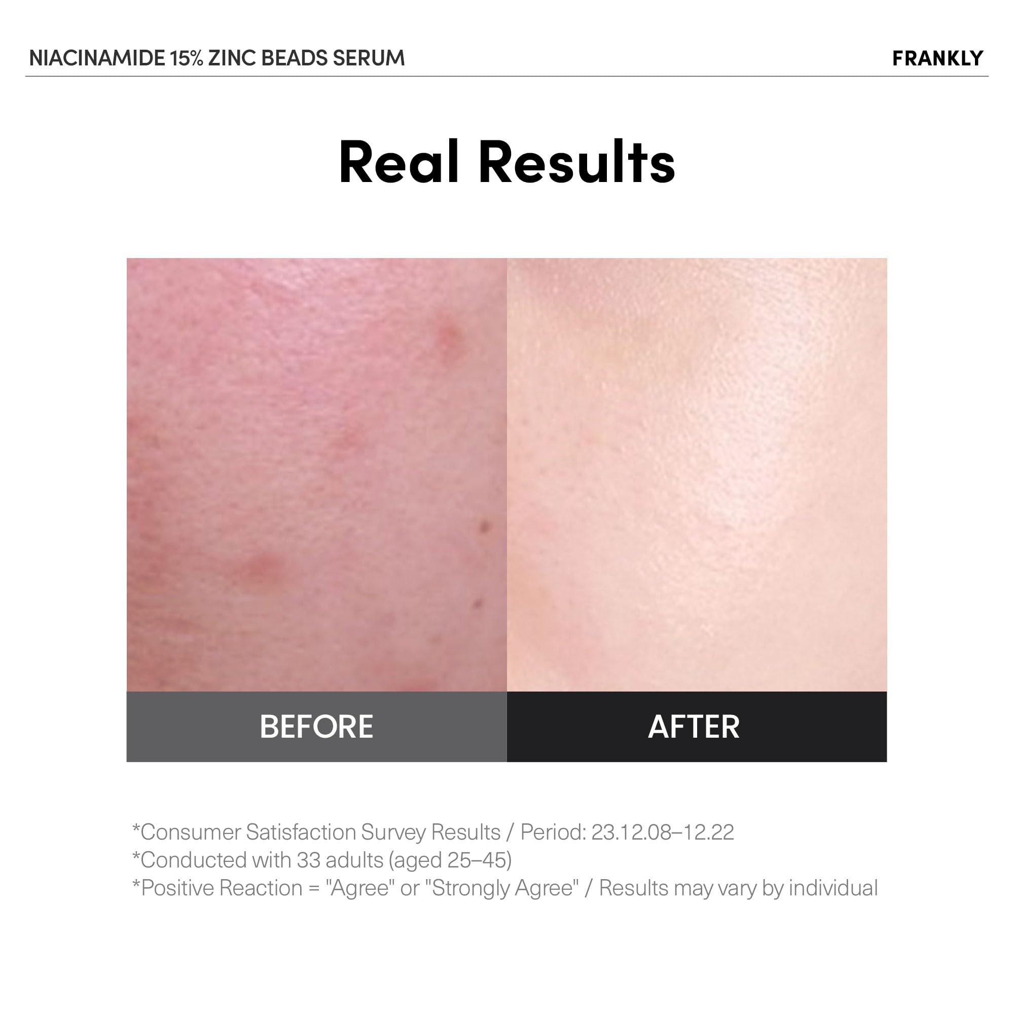 Perles encapsulées de zinc libérant le niacinamide pour une efficacité ciblée.