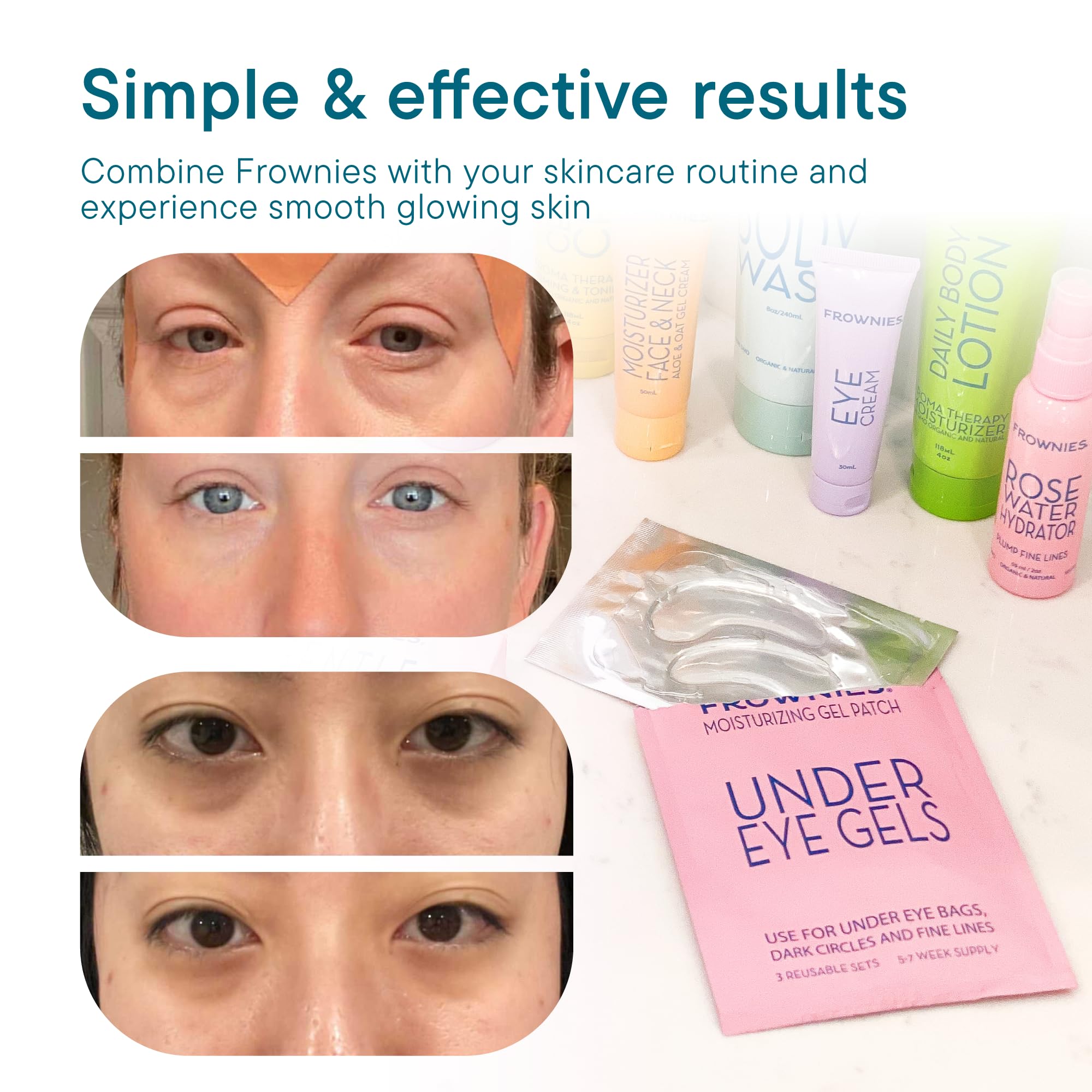 Patchs gel Frownies sous-yeux après routine pour peau douce et reposée.
