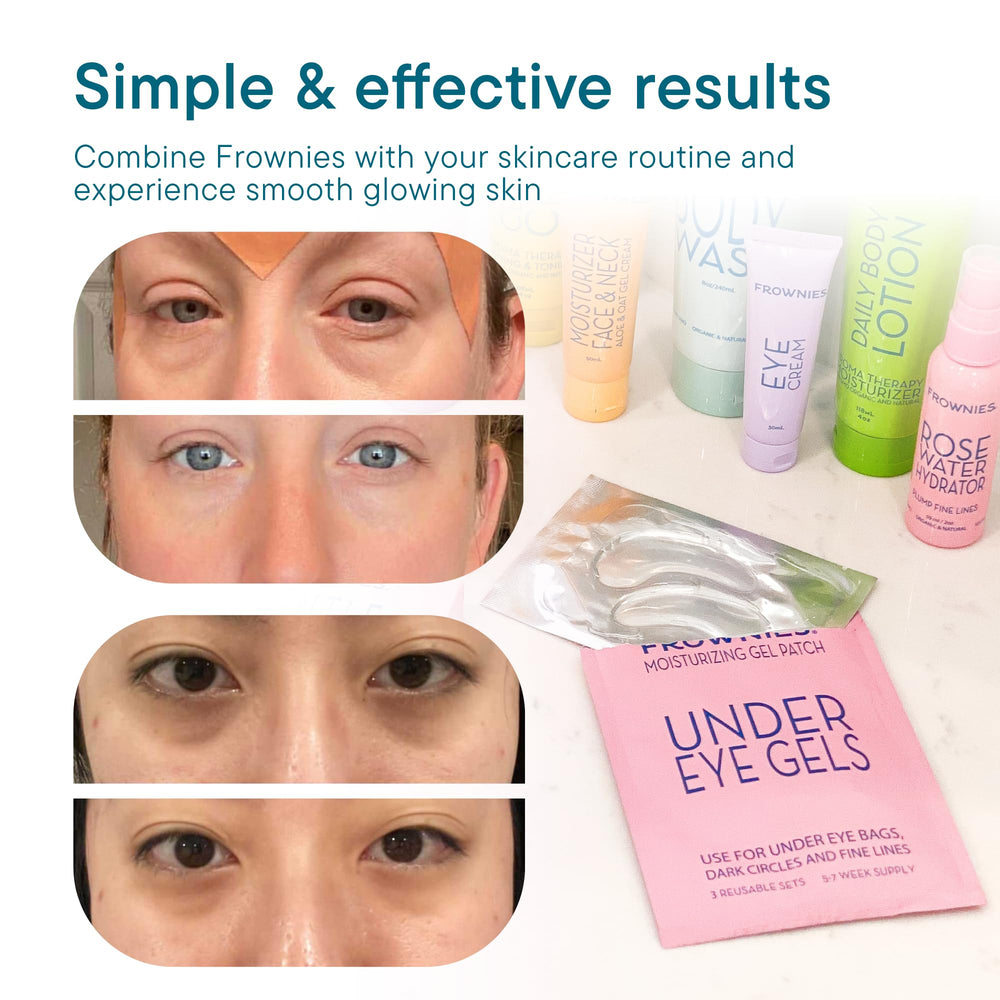 Patchs gel Frownies sous-yeux après routine pour peau douce et reposée.