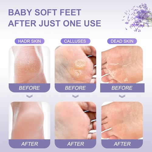 Funnir masque peeling pieds extraits naturels pour nourrir la peau.