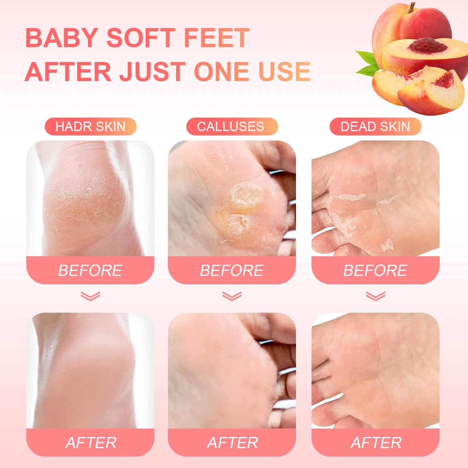 Callosités atténuées grâce au soin exfoliant FUNNIR.