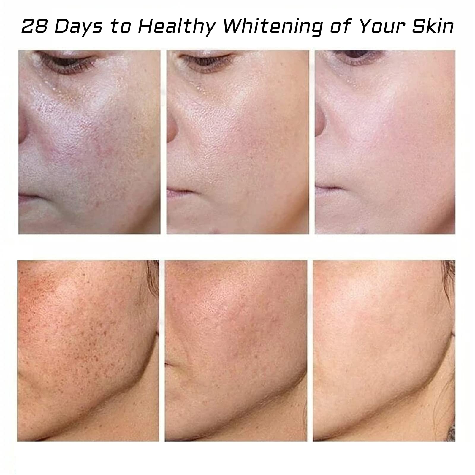 Fupah Crème cicatrices acne: soin hydratant pour peau lisse