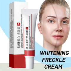 Fupah Crème éclaircissante mélasma visage: éclaircissant en douceur