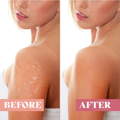 Gant exfoliant peau douce FURSINA, révèle une peau soyeuse après la douche.
