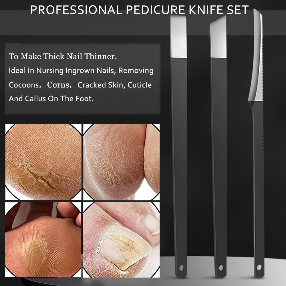 Leve-ongle incarné Fuwddy – aide précise pour les ongles incarnés
