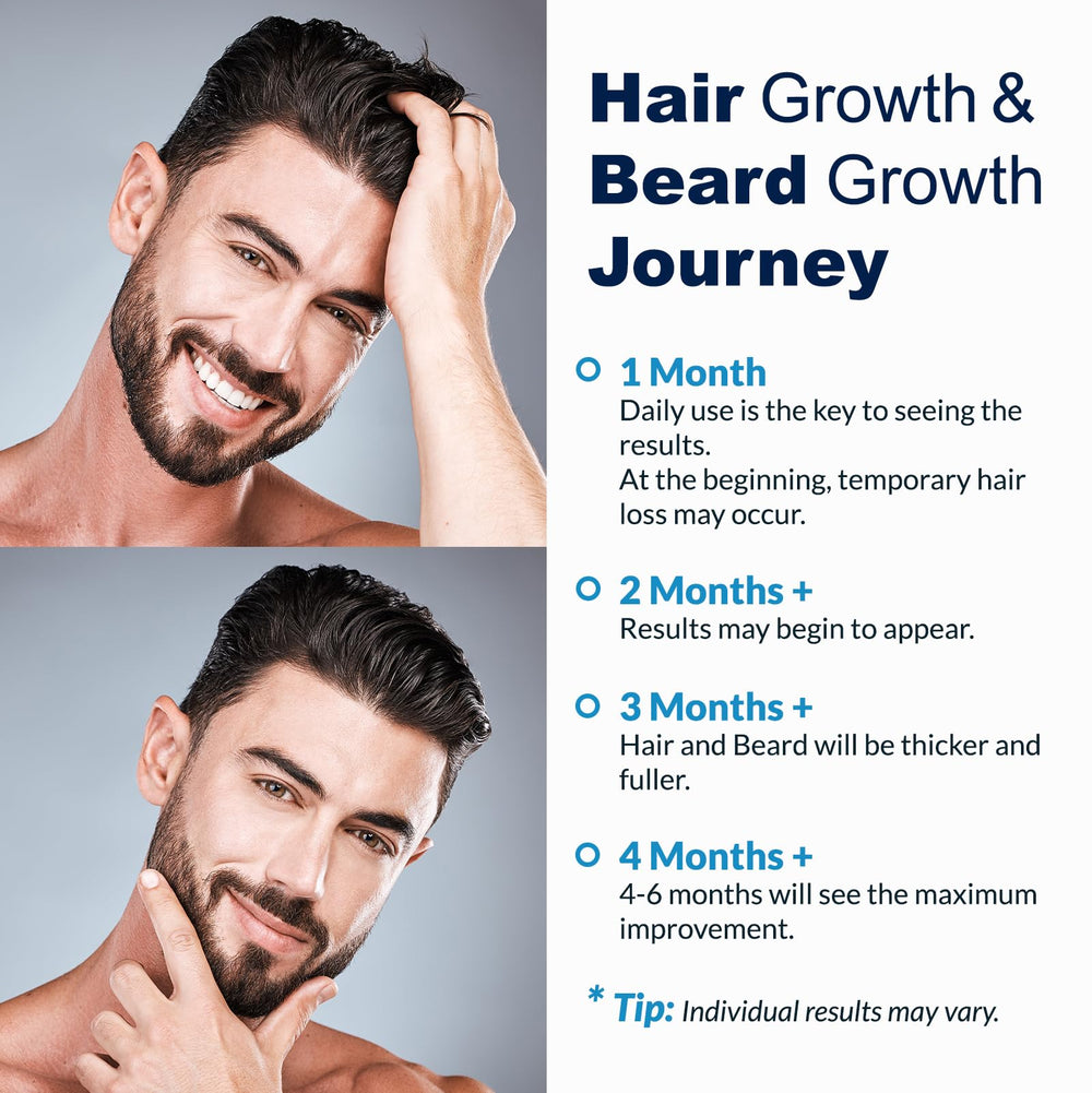 Le pack de quatre pièces FUZYAT Minoxidil 5% permet une routine durable.