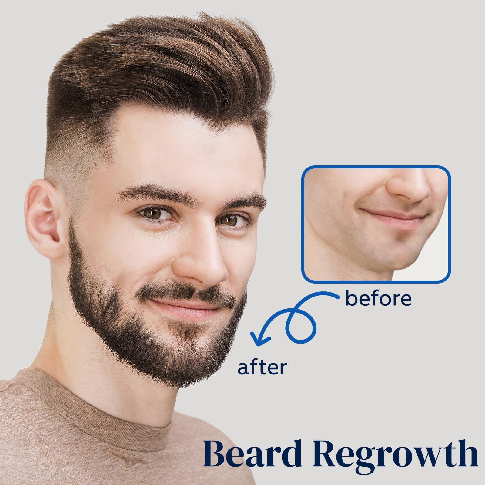 Le spray barbe FUZYAT Minoxidil 5% peut soutenir la pousse du poil facial.