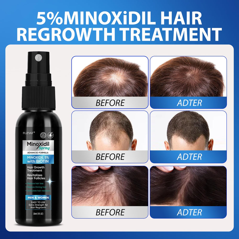 FUZYAT Minoxidil – appliquer-matin-soir, routine simple pour cheveux forts.