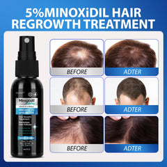 FUZYAT Minoxidil – appliquer-matin-soir, routine simple pour cheveux forts.