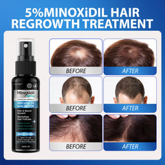 FUZYAT Minoxidil spray — format léger et pratique au quotidien.