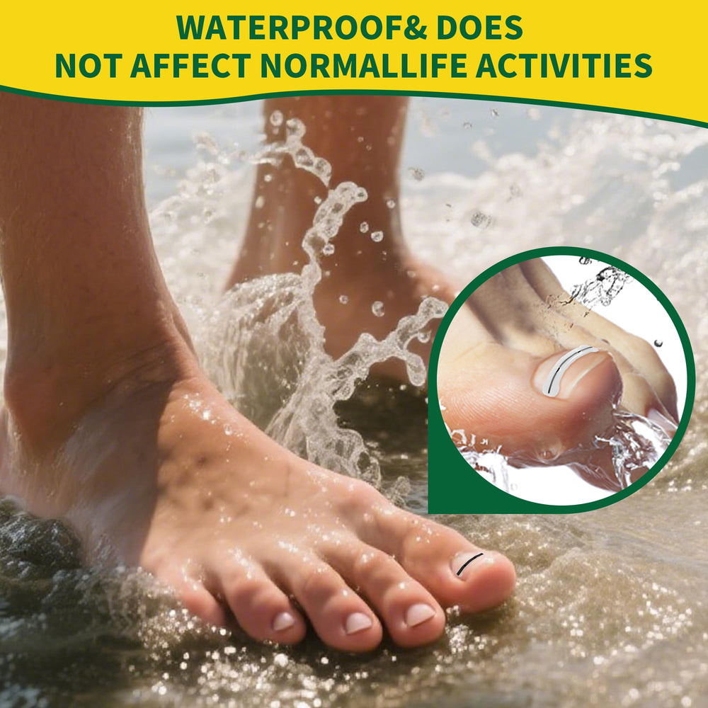 Fuzzycare service après-vente attentif: assistance rapide