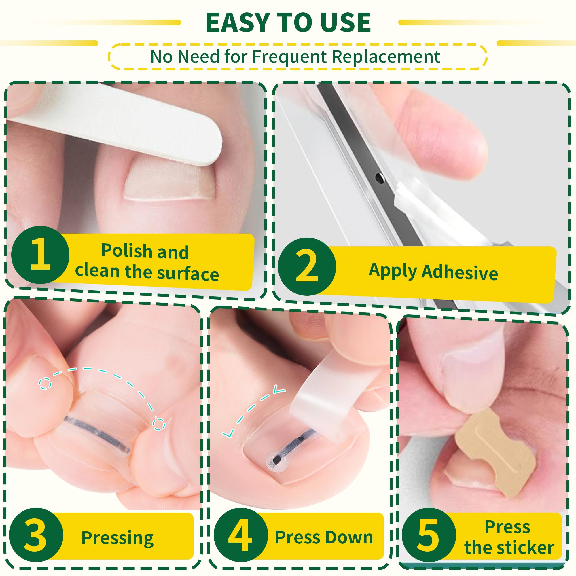 Fuzzycare tailles différentes pour ongles incarnés: ajustement personnalisé
