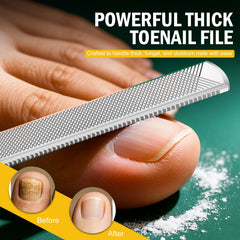 FVION levier pour ongle incarné, soulage la douleur et guide l'ongle dans la bonne position.