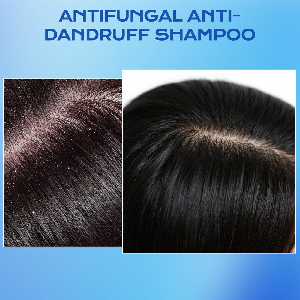FYZMTL Formule antifongique ingrédients ciblés pour les irritations.