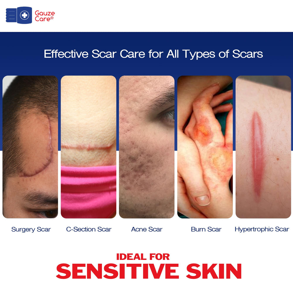 Gauze Care: cicatrices du visage, réduction visible des ridules possible.