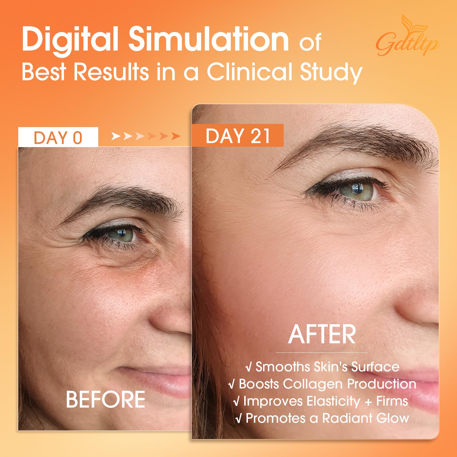 GDTLTP Serum DNA Saumon glutathione et niacinamide pour teint uniforme.