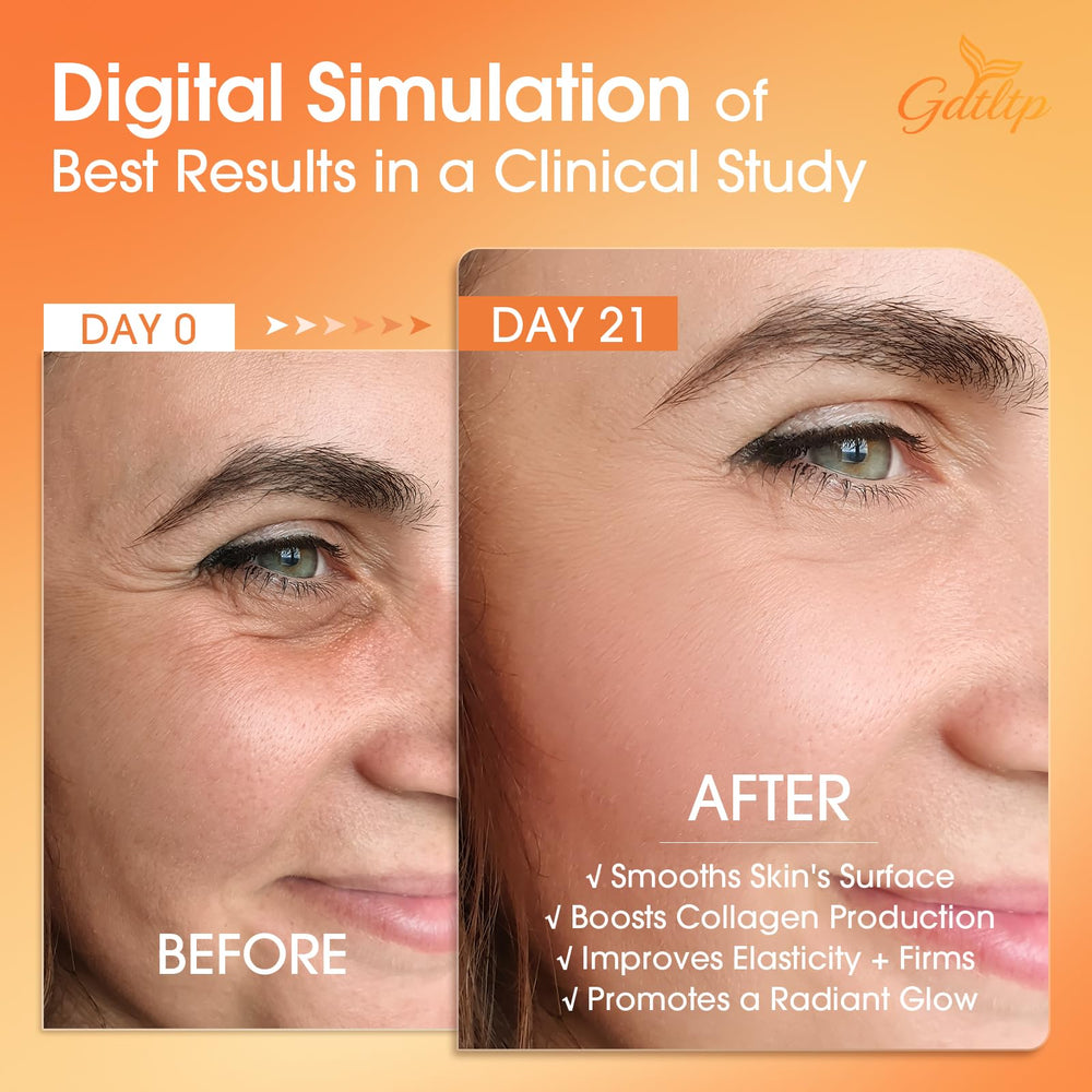 GDTLTP Serum DNA Saumon glutathione et niacinamide pour teint uniforme.