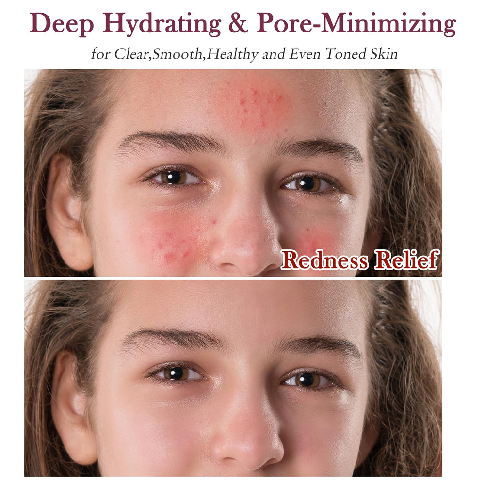 GEBEATY masque purifiant argile: purifie en profondeur et apaise les rougeurs.