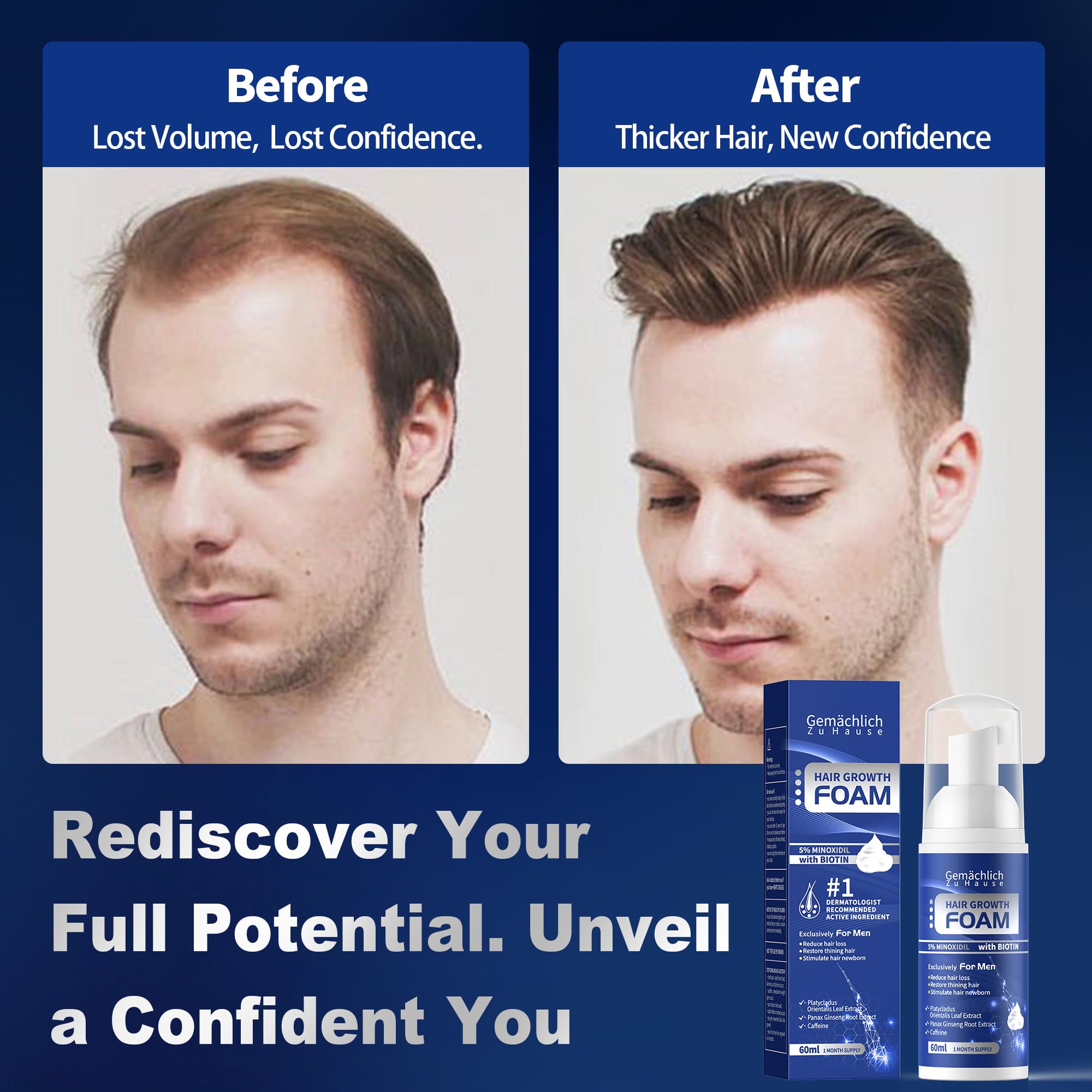 Routine simple matin et soir avec la mousse Minoxidil.