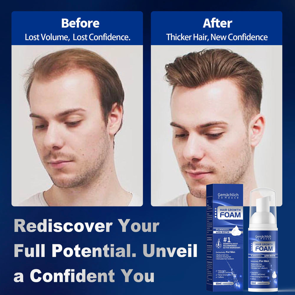 Routine simple matin et soir avec la mousse Minoxidil.