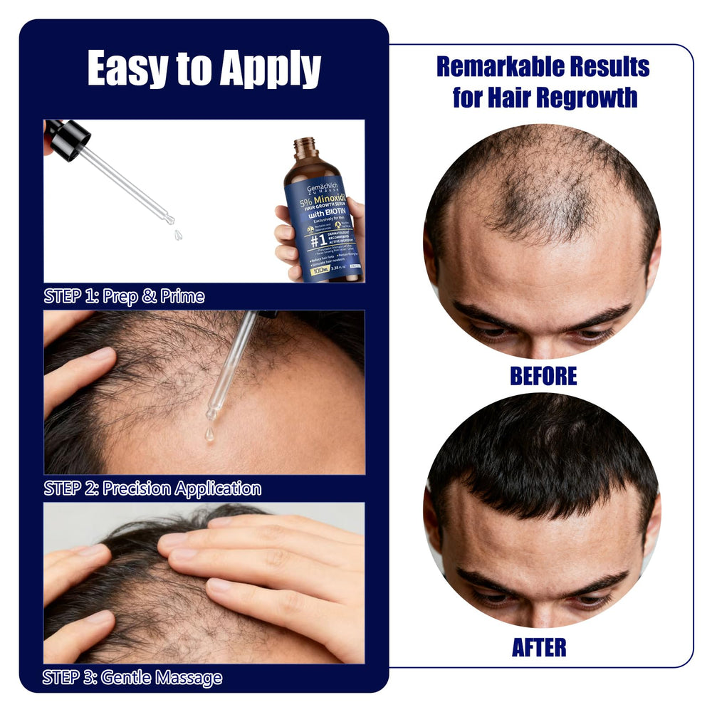 Goutte sur le cuir chevelu, Minoxidil Gemächlich Zu Hause, ciblage précis