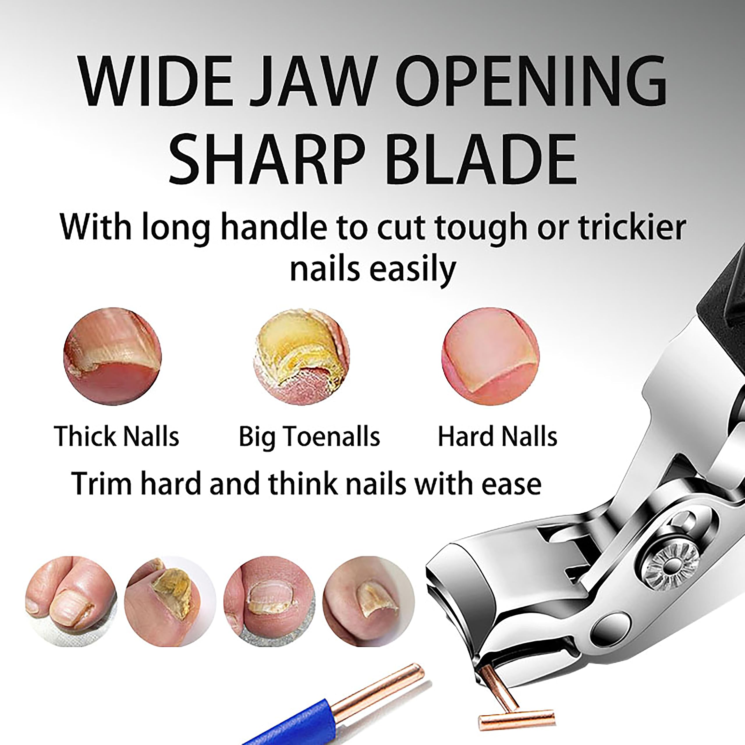 Goredny Orthoclip lame en V pour soulager les ongles incarnés