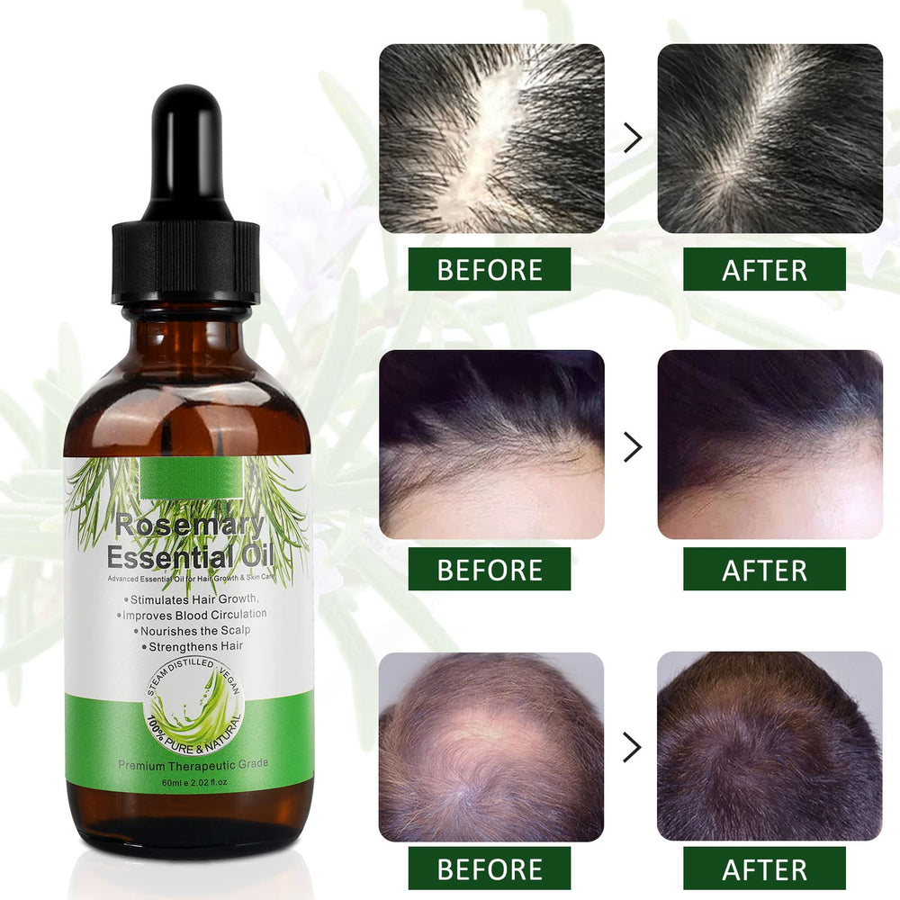 Application sur le cuir chevelu avec huile de romarin Generic, massage relaxant