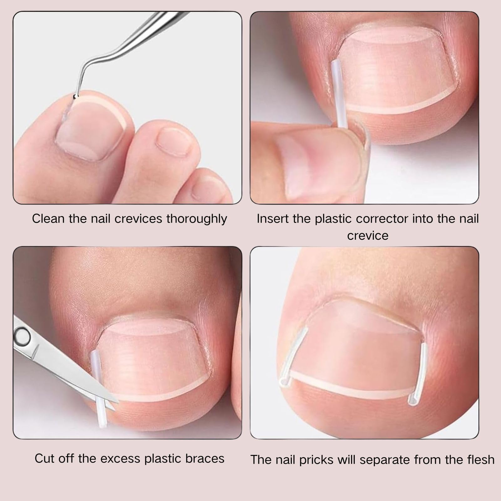Generic levier ongle doux, bords lisses pour une utilisation sûre.
