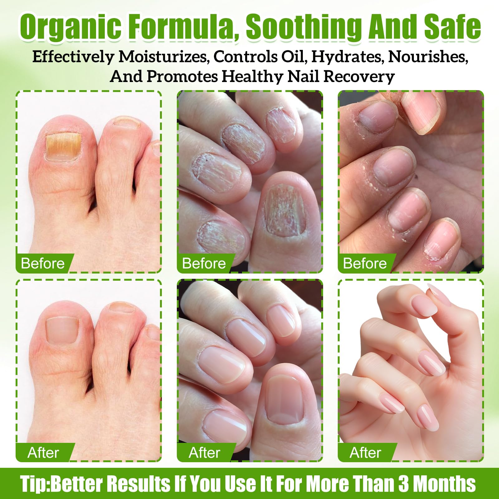 GHENGUA huile de jojoba et arbre à thé – revitalisation naturelle des ongles