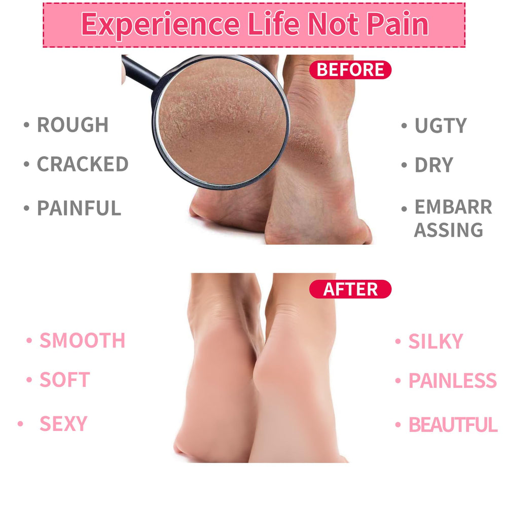 Deux paires disponibles en rose et vert, idéal cadeau soin des pieds.