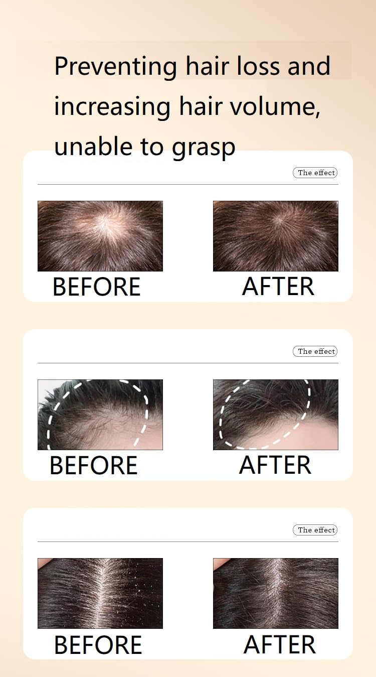 Ginaday Shampoing Gingembre - Mousse: nettoyage en profondeur du cuir chevelu.