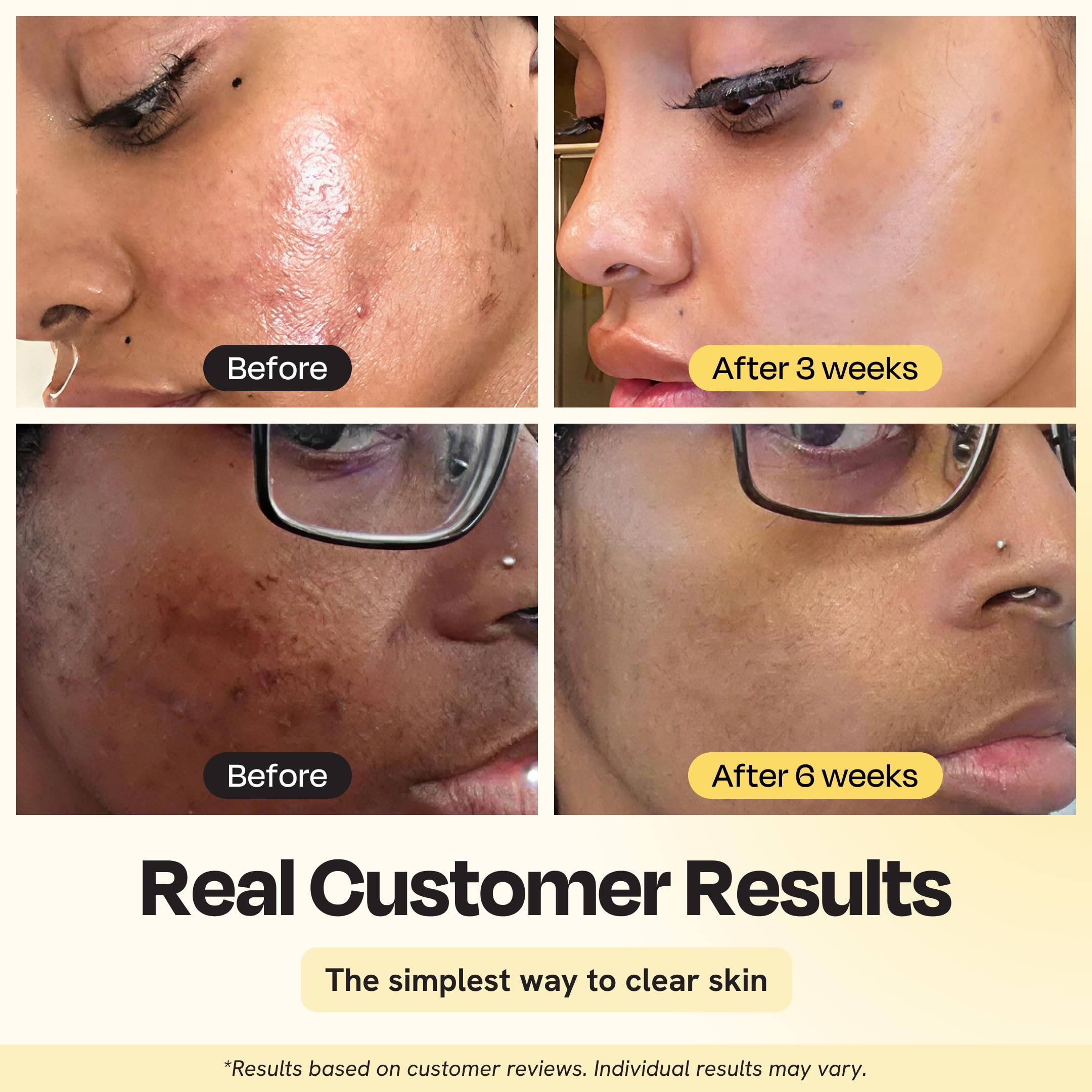 Gleamin Brillance Teint Visage : masque argile curcuma pour un teint lumineux et homogène.
