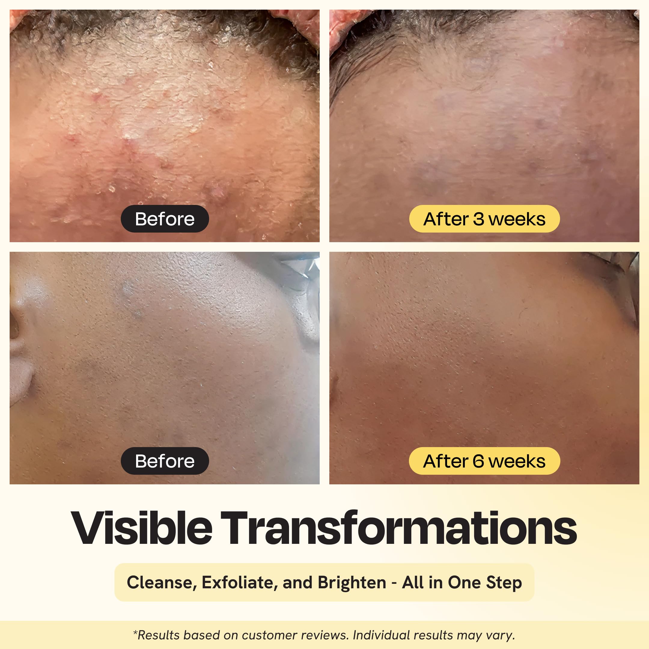 Gleamin nettoyant-visage vitamine C, mousse légère, révèle un teint frais et lumineux.
