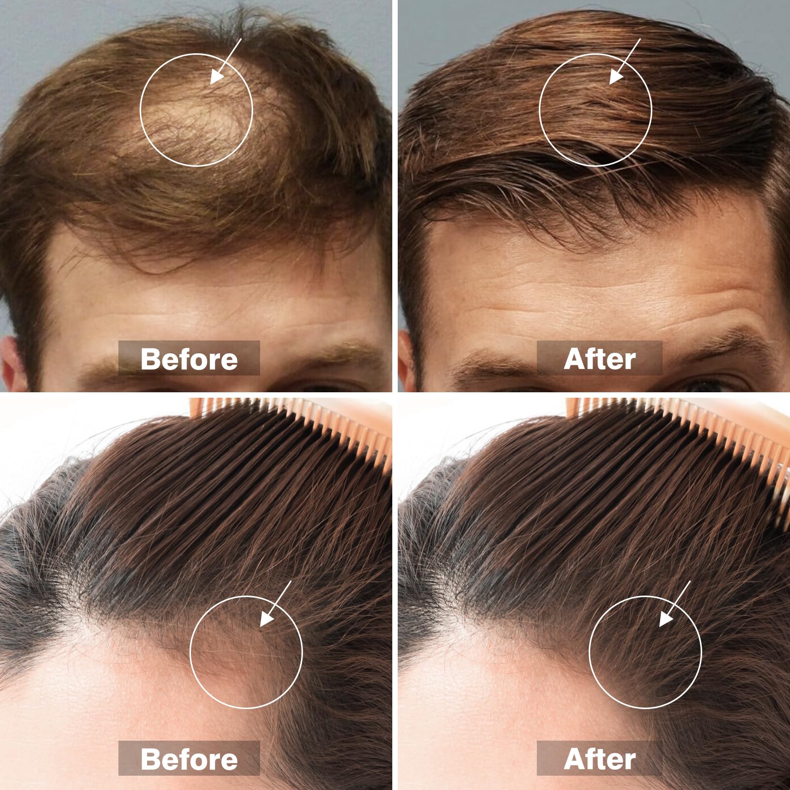 Glemme – sérum barbe et cheveux, solution polyvalente