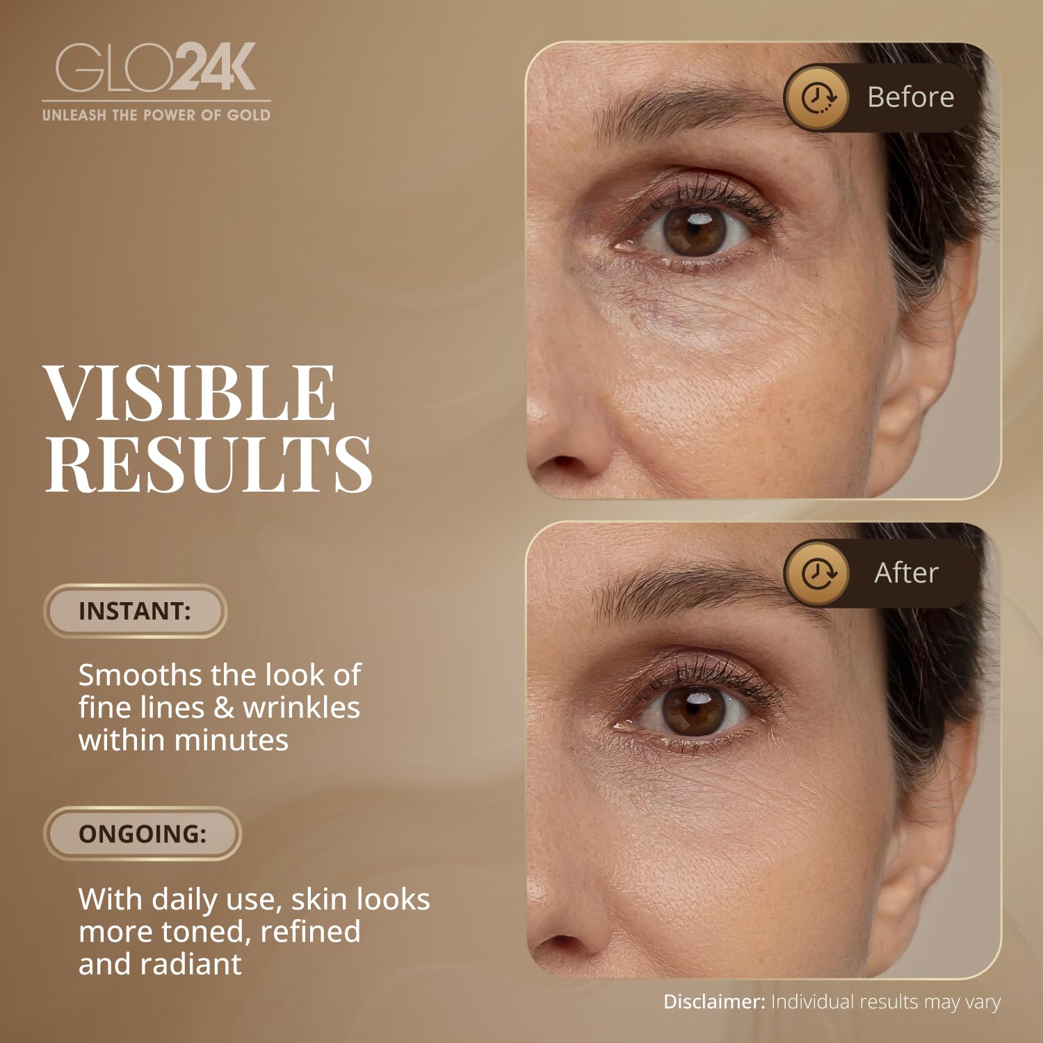 Séringue sans aiguille GLO24K pour une application ciblée.