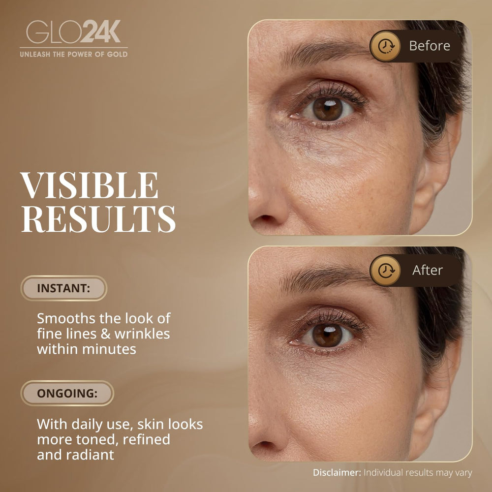 Séringue sans aiguille GLO24K pour une application ciblée.