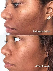 Glossier Solution exfoliant, conteneur-presentation, expérience sensorielle pour une peau plus claire.