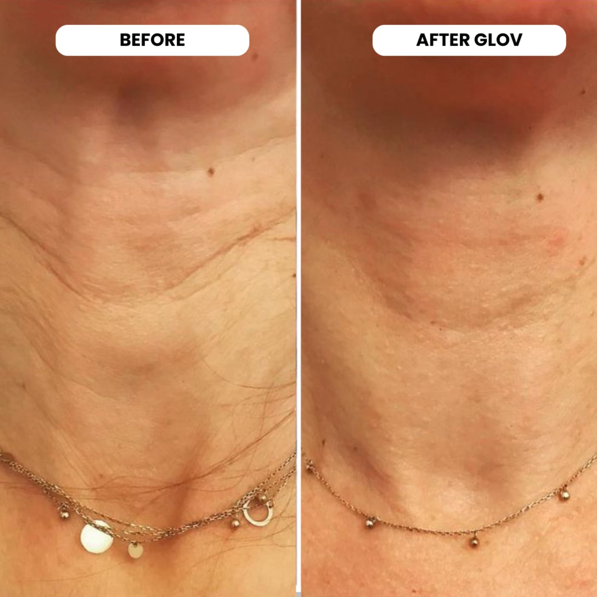Glov Beauty tête stamp or 24k stérile assure une utilisation hygiénique.