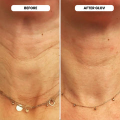 Glov Beauty tête stamp or 24k stérile assure une utilisation hygiénique.
