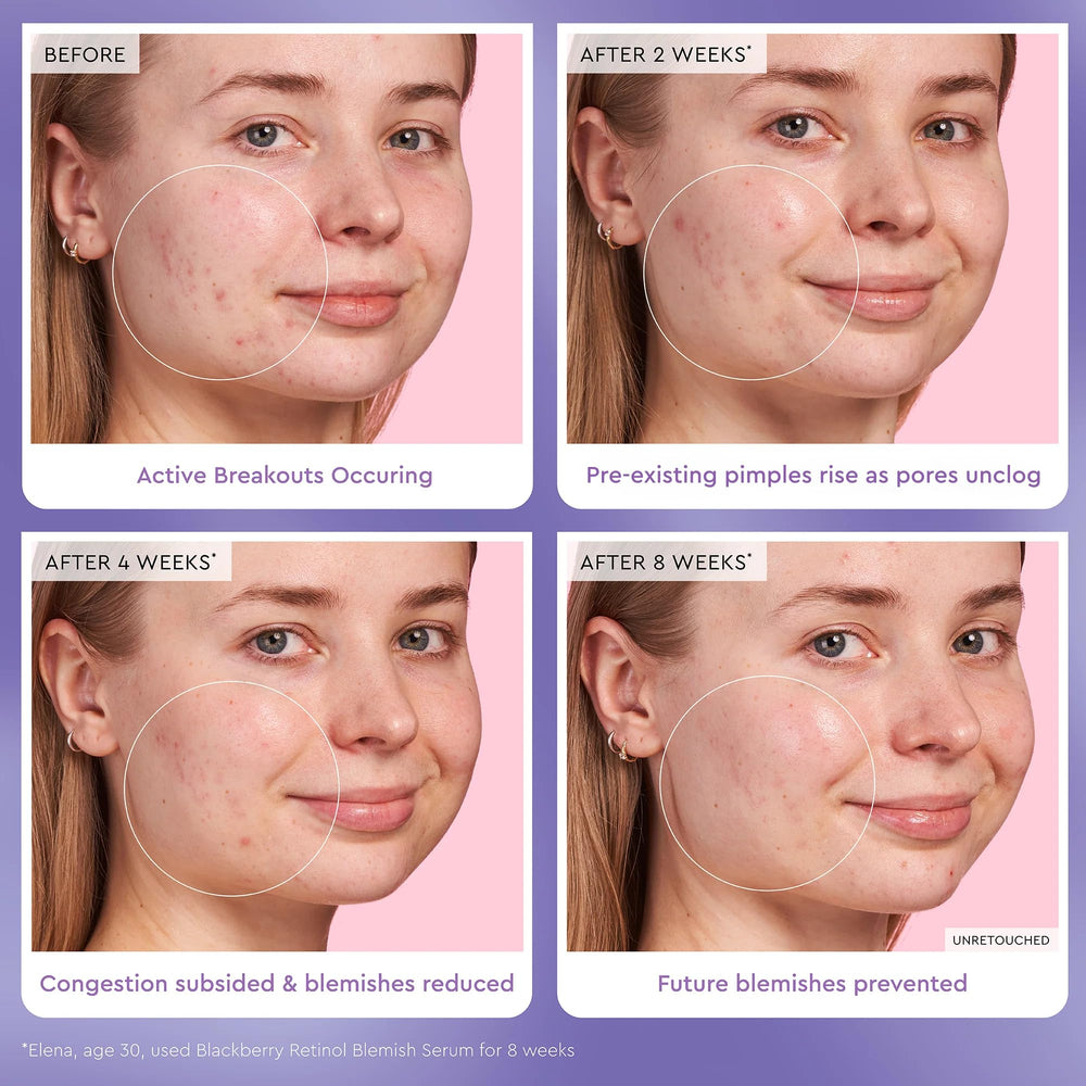 Potentiel clairifiant des impuretés et texture plus lisse.