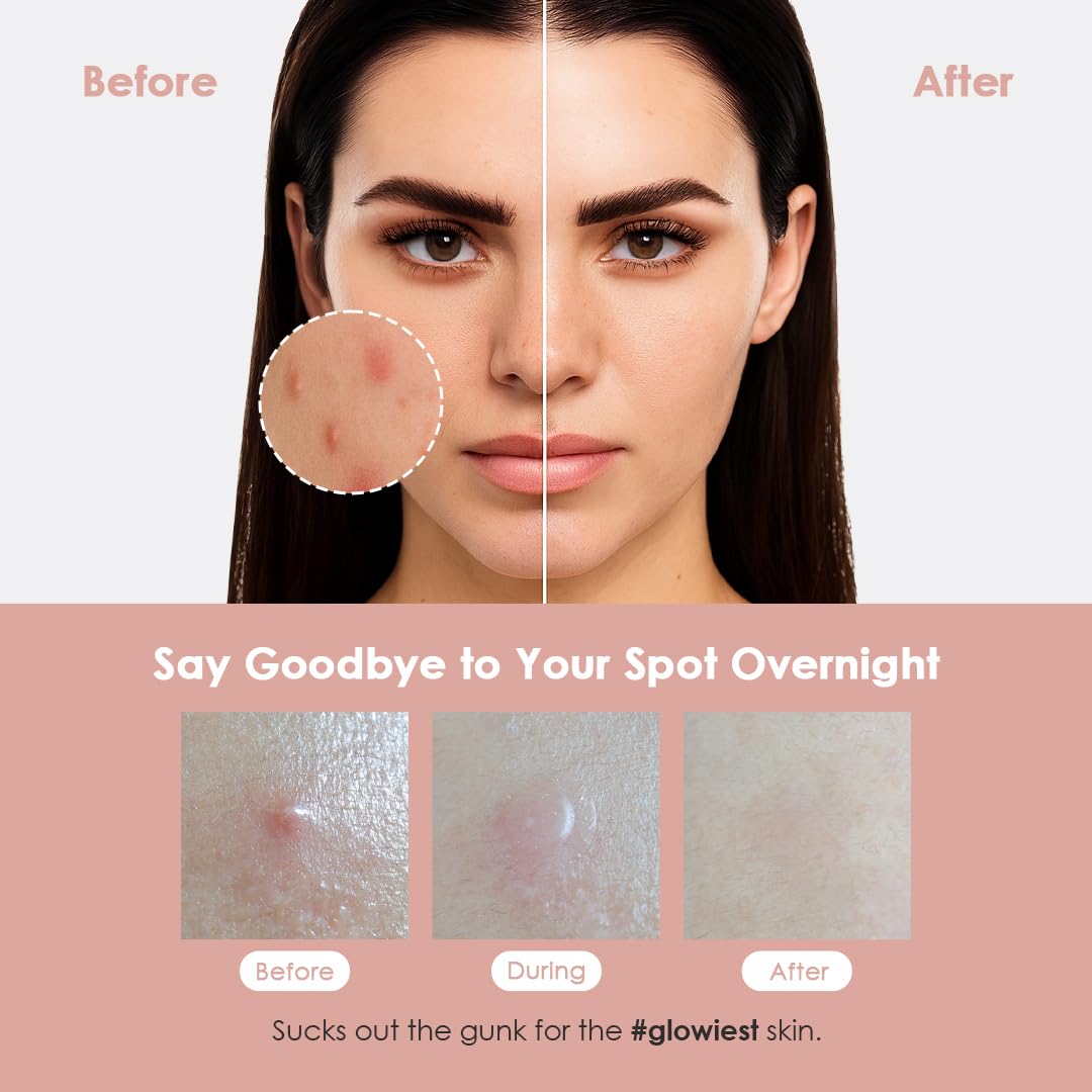 Patch Glowiest avec niacinamide : peut aider à atténuer l'apparence des taches.