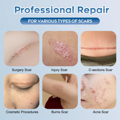 Glowor gel silicone cicatrices application fine couche – facile à appliquer sans résidu.