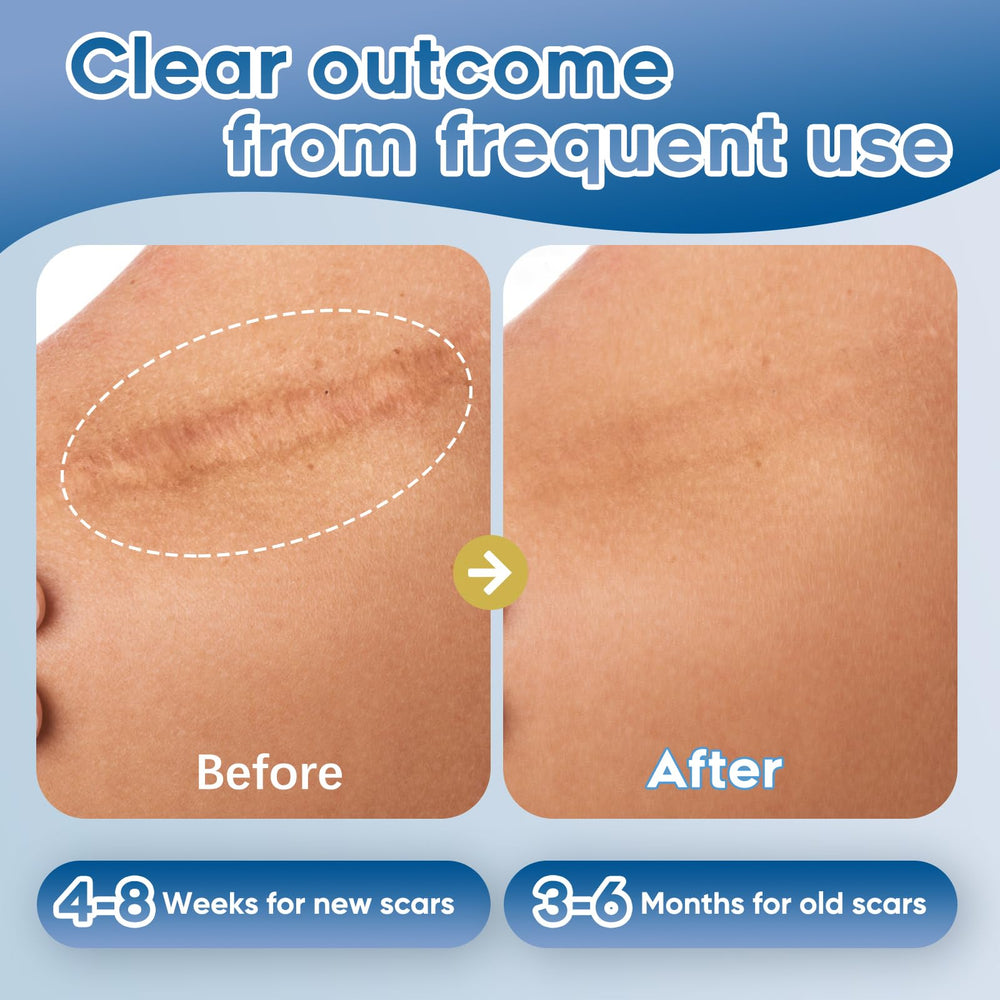 Glowor gel silicone cicatrices formule douce – sans parfum, hypoallergénique.