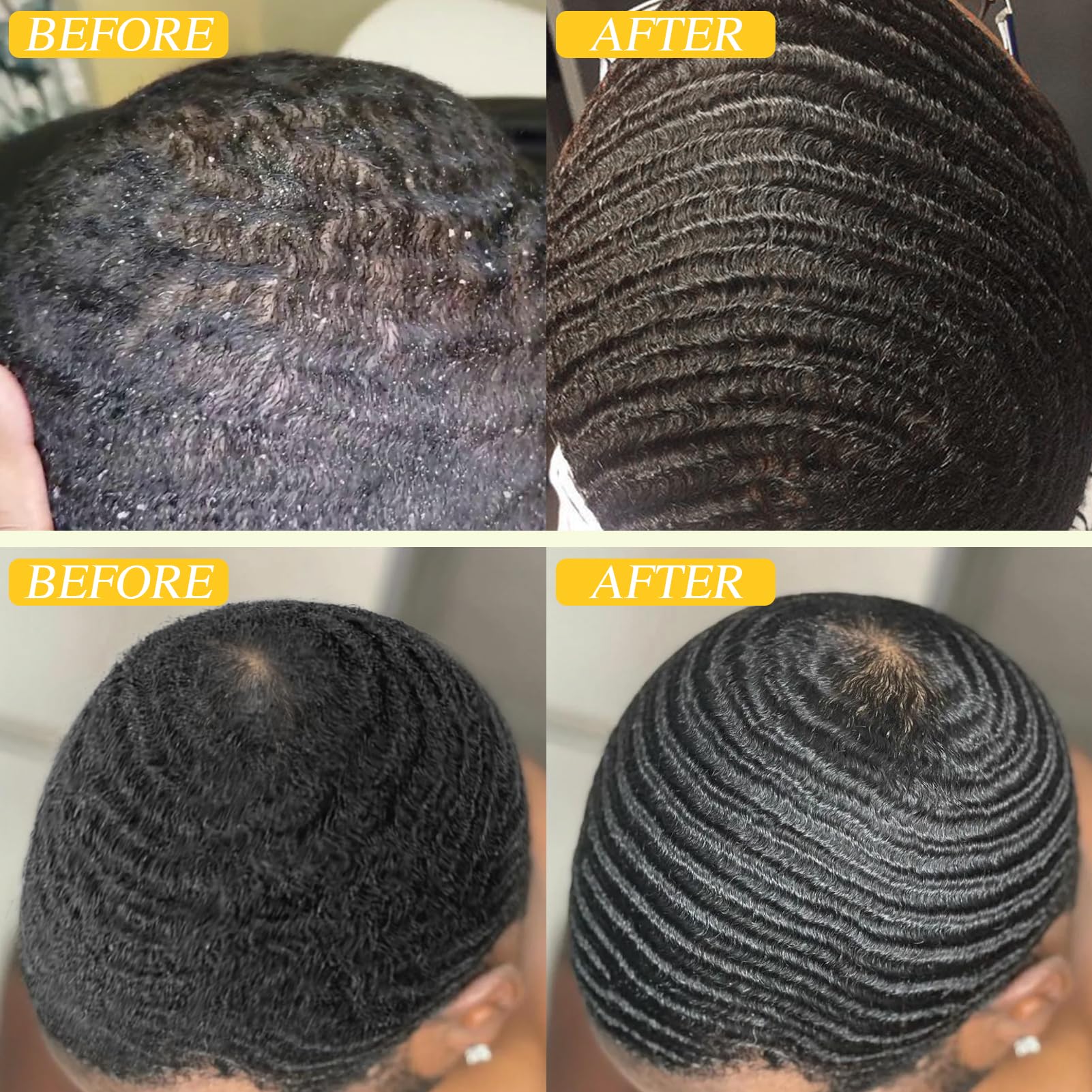 Goiple botanical scalp revival with rosemary tea tree for a balanced scalp