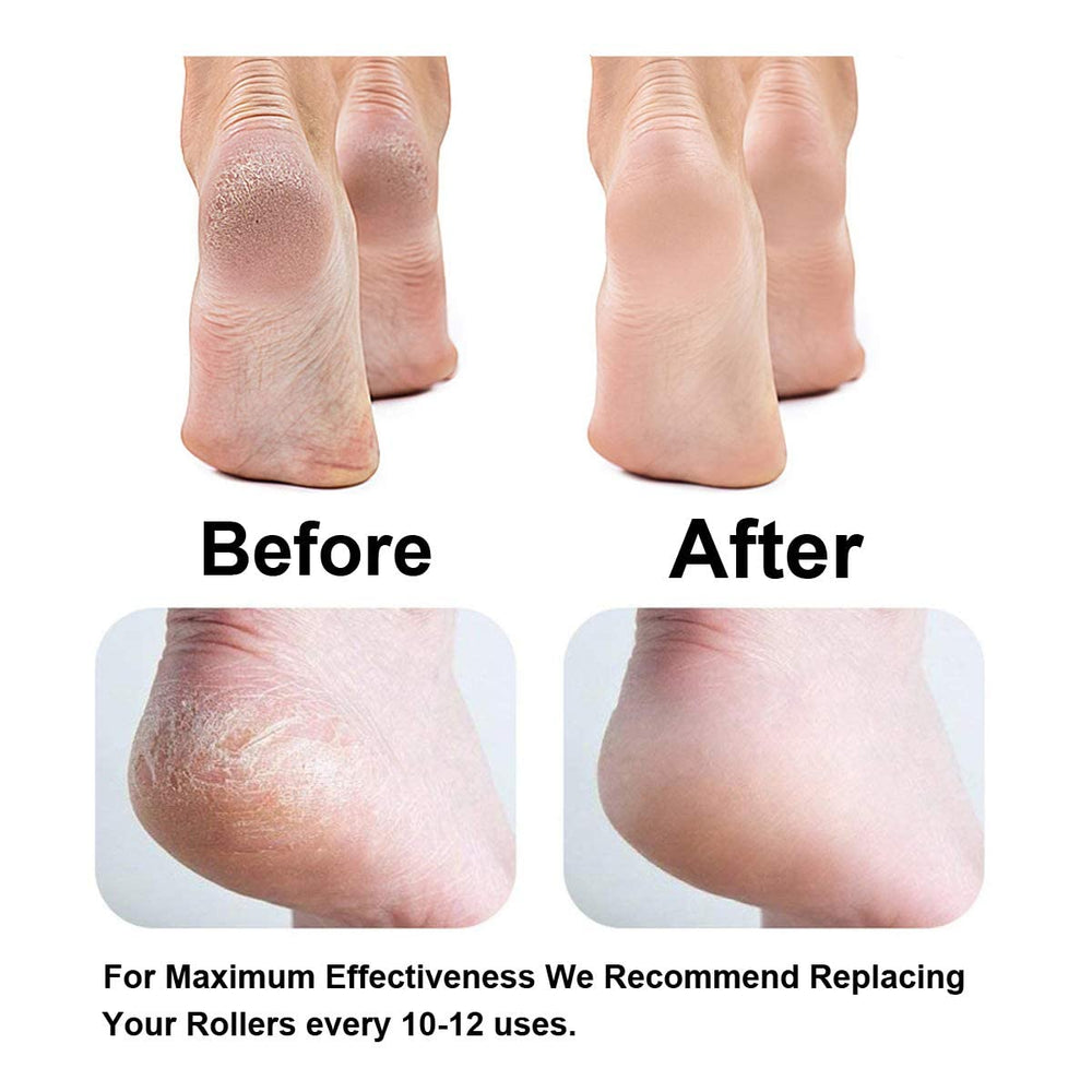 gominyuf compatibilité avec Dr. Scholl's Remover pour résultats optimisés
