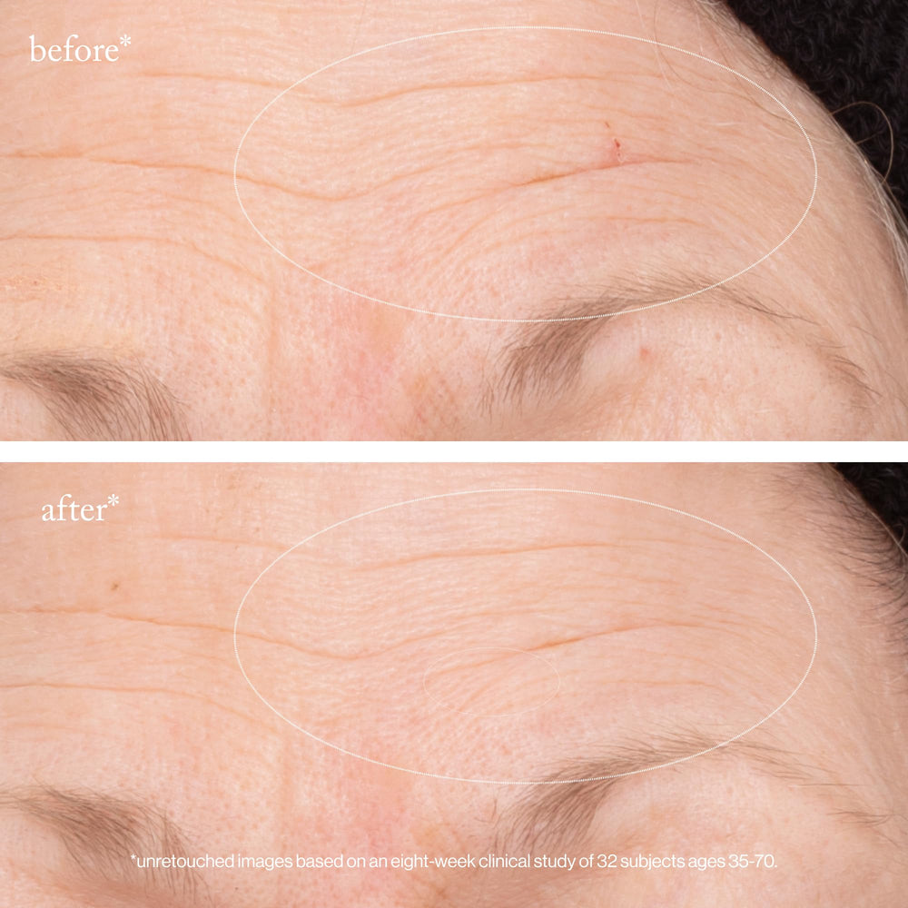 Avant/après conceptuel avec Goop 3x Retinol et éclat amélioré.