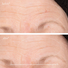 Avant/après conceptuel avec Goop 3x Retinol et éclat amélioré.