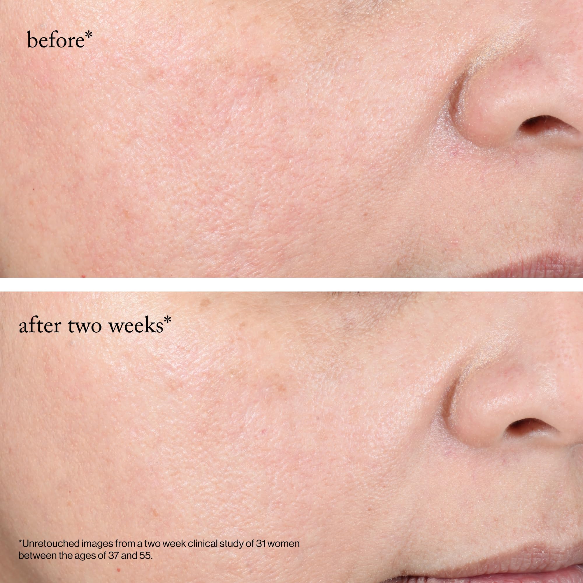 goop zone visage cou décolleté bénéficie d une exfoliation douce.